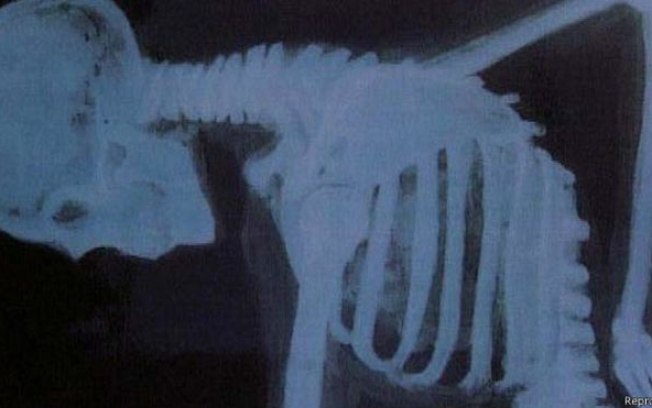 Leia mais sobre o artigo Saiba mais sobre a fratura por estresse da coluna